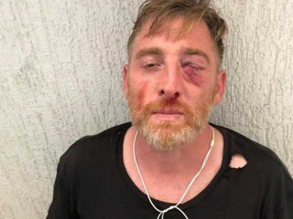 У Грузії помер журналіст, якого жорстоко побили противники ЛГБТ-спільноти