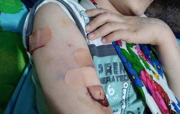 На Херсонщині поліцейським довелося застрелити бійцівську собаку, яка напала на дітей