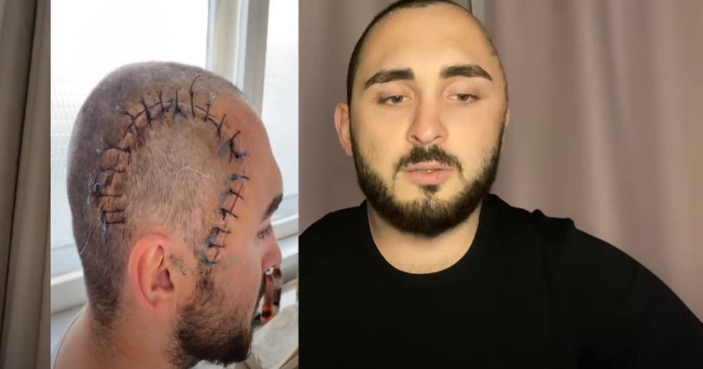 У Києві чоловік попросив у перехожих цигарку і ледь не помер від удару по голові