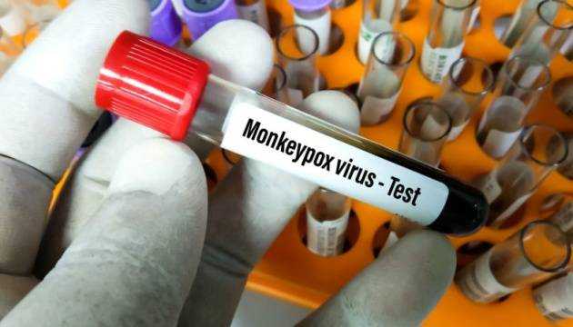 В Україні знову зафіксували зараження віспою мавп
