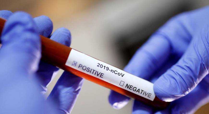 "Нас кинули": украинский бизнес взвыл из-за коронавируса