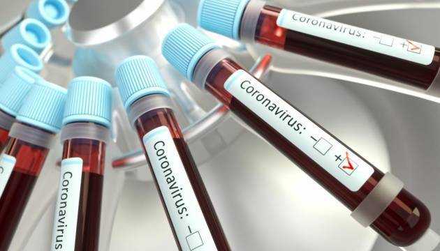 Медики назвали опасные места, где риск подхватить COVID-19 особенно велик