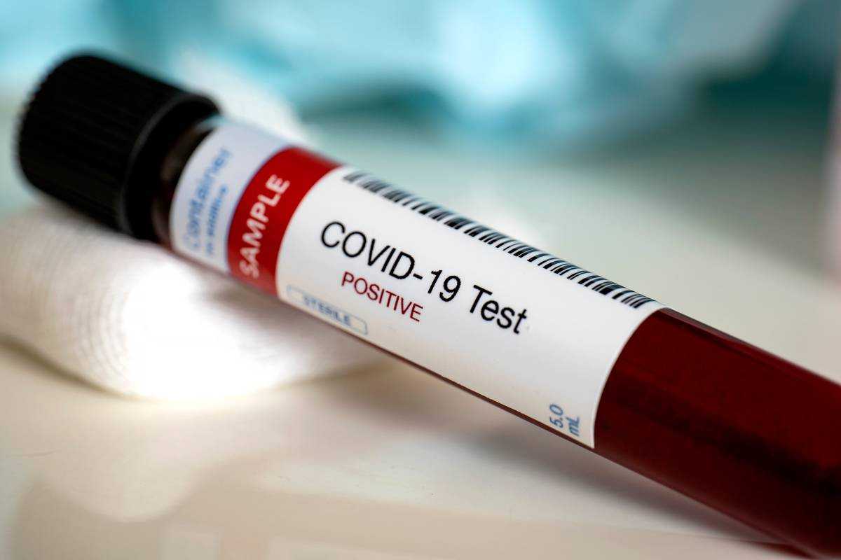 В Украине четвертый день подряд рекорд по COVID-19
