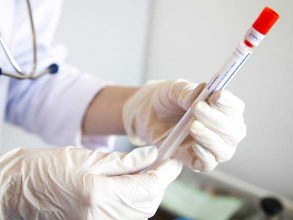 В Україні вже 1,347 млн випадків COVID-19, за добу - 5 833