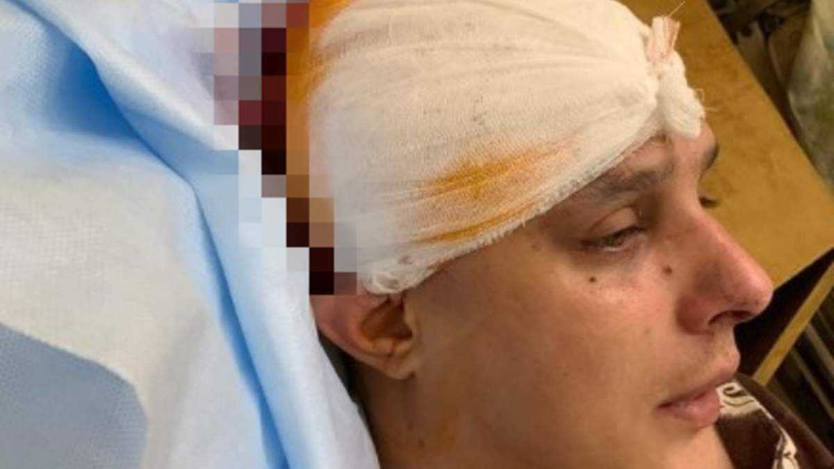 В Києві жорстоко побили автора пісень гурту KAZKA : відкрито провадження