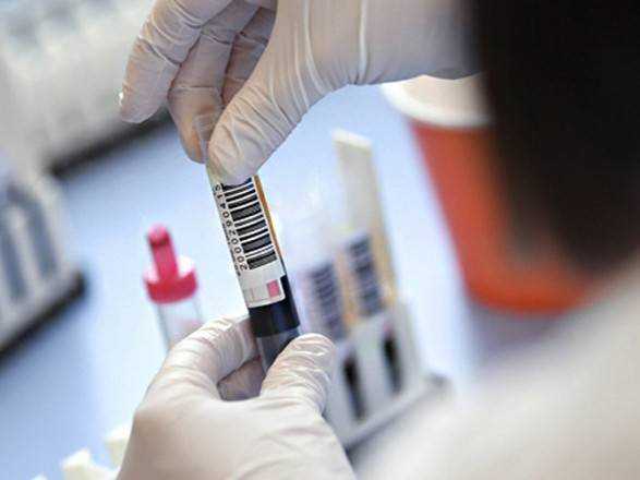 За сутки в Днепропетровской области обнаружили 15 новых случаев COVID-19