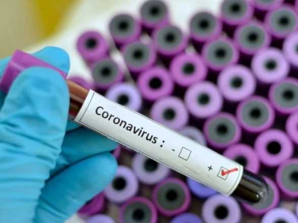 В Украине 78% больных COVID-19 люди до 60 лет - Зеленский