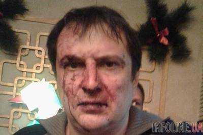 В Днепропетровске произошла драка между полицейским и жителем: открыто уголовное производство