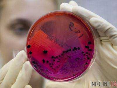 В Швеции выявлена вспышка сибирской язвы