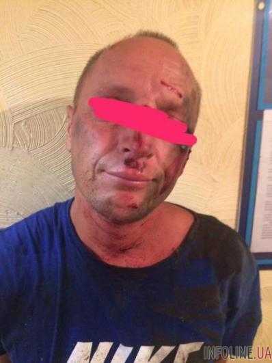 Жестокости нет предела: убийство детей шокировало всю Одессу