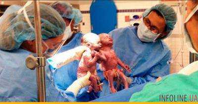 Близнецы родились, держась за руки. Невероятные фото