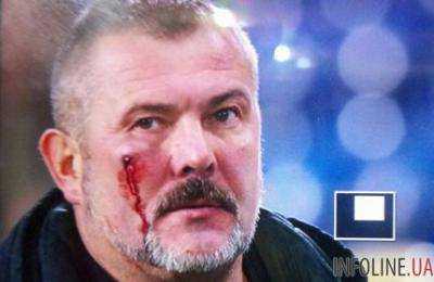 Фанаты «Днепра» избили нардепа Юрия Березу