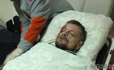 Ляшко назвал свои версии покушения на Мосийчука