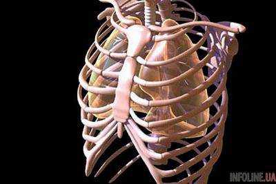 Пациенту с раком напечатали грудную клетку на 3D-принтере