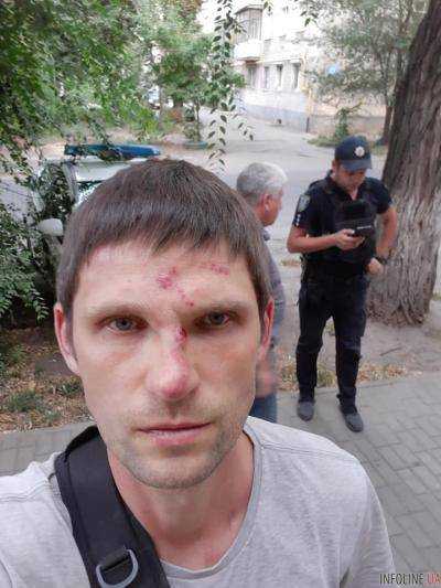 В Днепре "за улыбку" избили мужчину