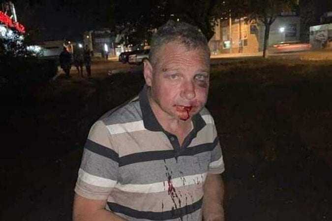 Живодер из Днепра, который перерезал горло собаке, покончил с собой