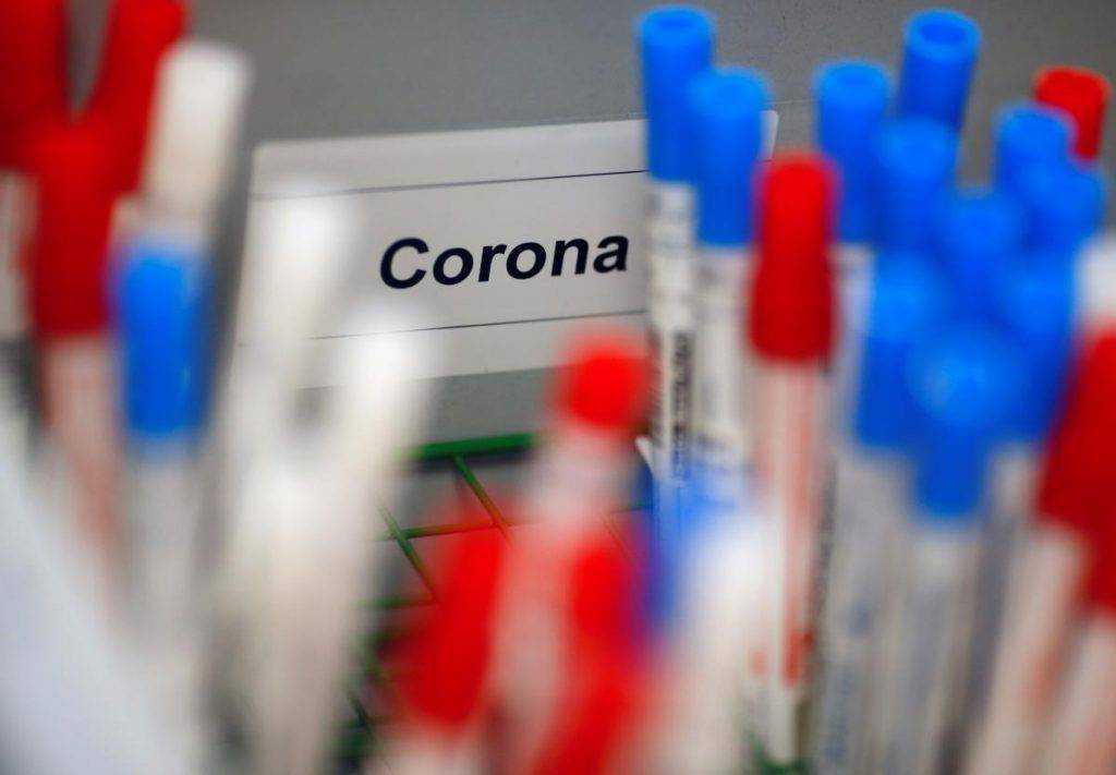 В Украине уже 1,227 млн случаев COVID-19, за сутки - 3 285