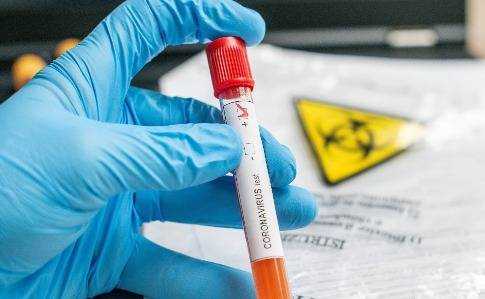 Медики рассказали о необычных симптомах у пожилых пациентов с COVID-19