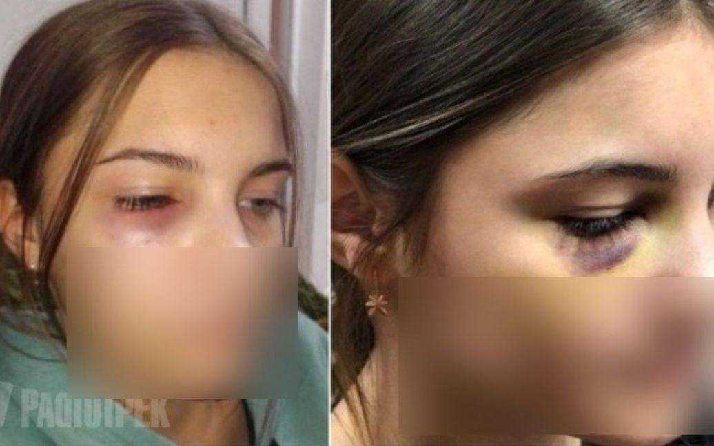 Повалив на підлогу та бив ногами: у Рівному семикласник побив свою однолітку
