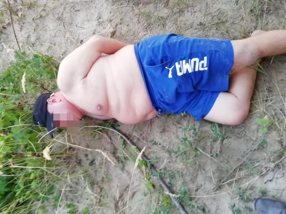 Шокирующее нападение под Киевом: в мужчину выстрелили 7 раз 2