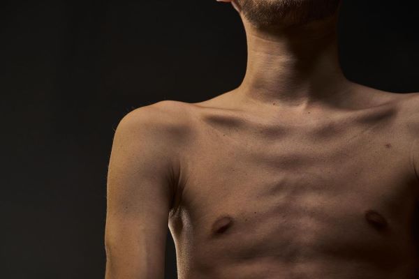 "Ніколи не хотів виглядати жертвою": фотографи показали знімки захисника Азовсталі "Ореста" після полону1