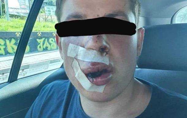 В Польше жестоко избили студента из Украины