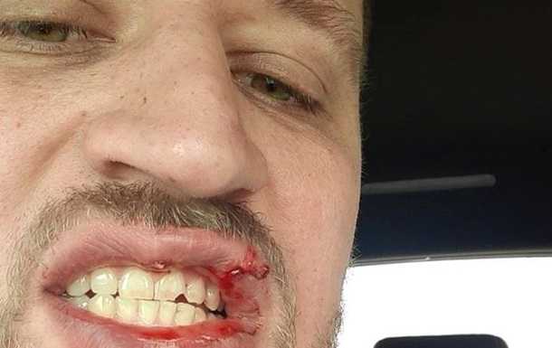 Ветеран АТО подвергся нападению в Киеве