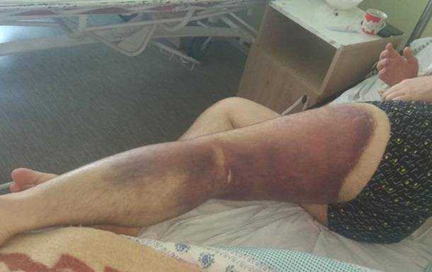 В Николаеве 6 полицейских подозреваются в пытках