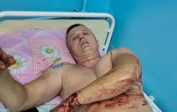 Среди раненых в Покровске - герой фильма 20 дней в Мариуполе