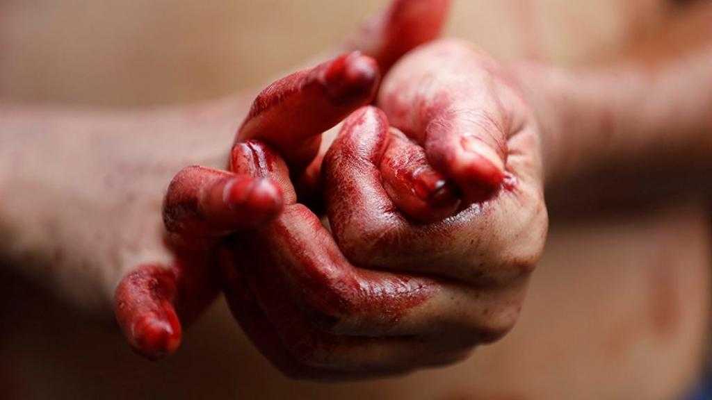 Ужасная находка: в Симферополе в авто обнаружили зарезанного  7-летнего ребенка