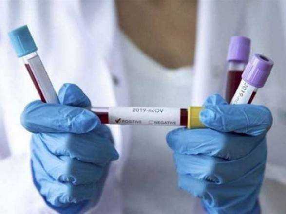 В Запорожье уже 19 случаев коронавируса