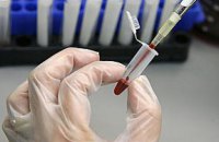 Случаев холеры в Украине не зафиксировано - Минздрав