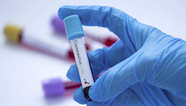 Украинцев будут наказывать за подделку тестов на COVID-19