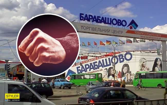 Попал в реанимацию с инсультом: в Харькове во время съемок напали на журналиста