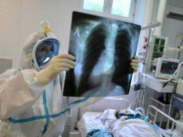 Ковідна пневмонія: інфекціоніст розповів, що допомагає при важких формах і для профілактики