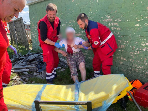 Отбросило ударной волной: пожилая женщина и двое детей пострадали в результате атаки рф на Киевщину
